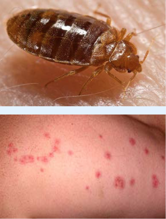 Top 7 Effective Ways to Get Rid of Bed Bugs in Just One Day – 2025 Edition