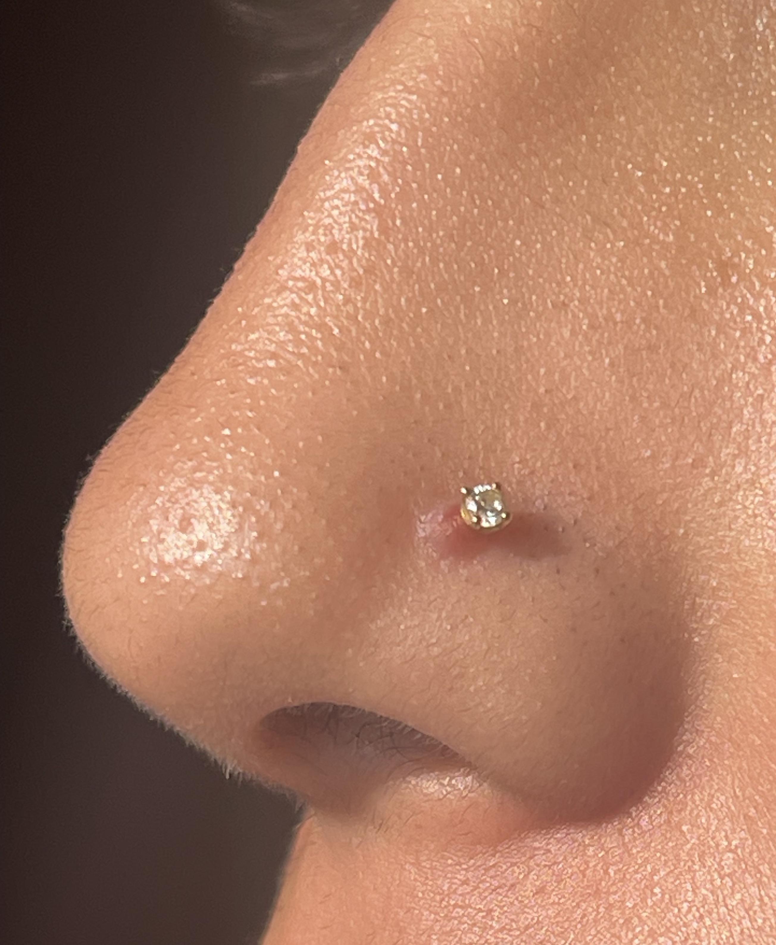 Effective Ways to Get Rid of a Piercing Bump