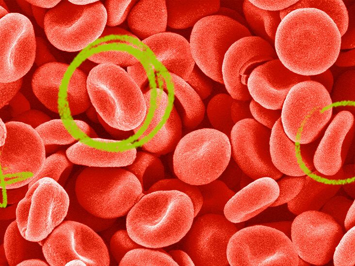 Top 5 Effective Ways to Increase Hemoglobin Levels Quickly in 2025